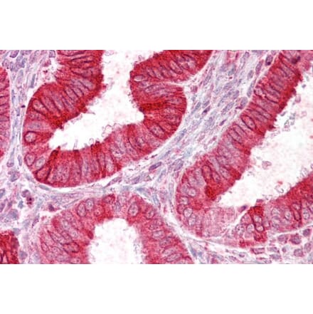 Immunohistochemistry - Anti-SCNN1D Antibody (A285998) - Antibodies.com