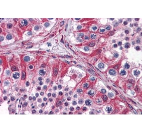 Immunohistochemistry - Anti-PACE4 Antibody (A285999) - Antibodies.com