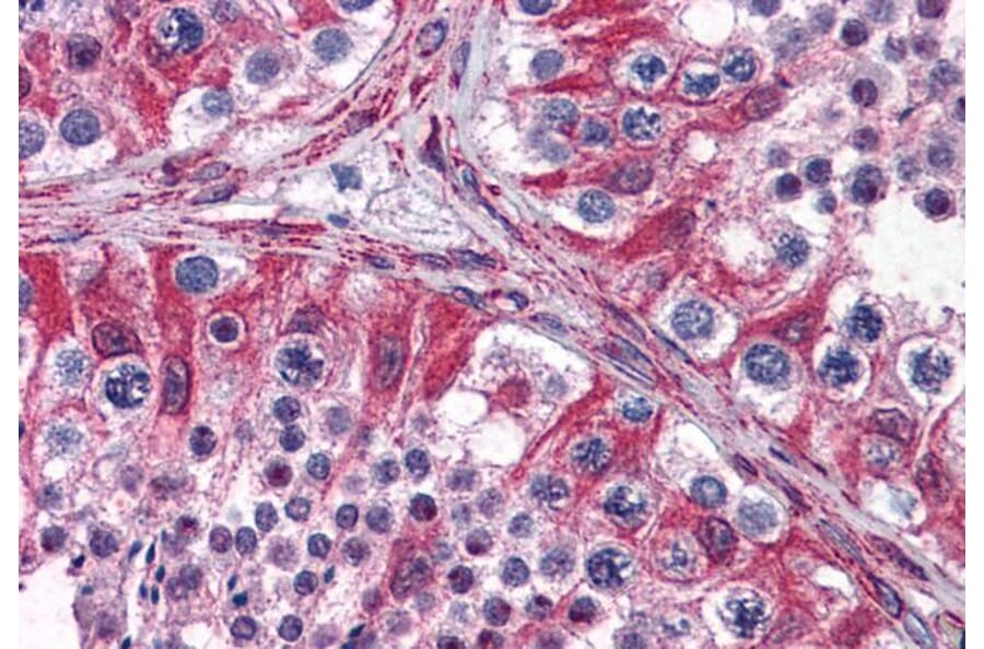 Immunohistochemistry - Anti-PACE4 Antibody (A285999) - Antibodies.com