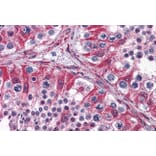 Immunohistochemistry - Anti-PACE4 Antibody (A285999) - Antibodies.com