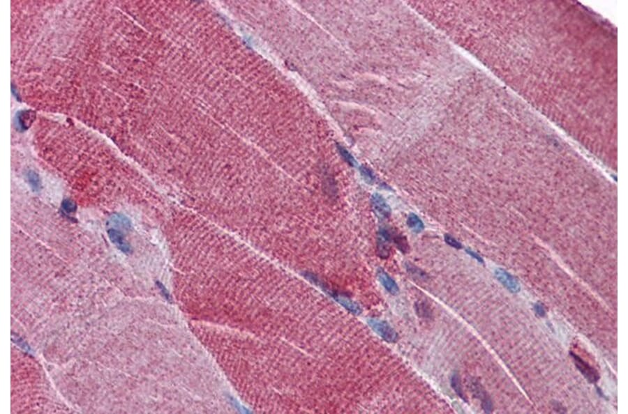Immunohistochemistry - Anti-PACE4 Antibody (A285999) - Antibodies.com