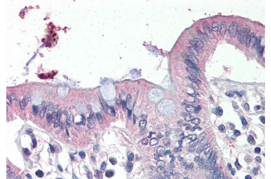 Immunohistochemistry - Anti-SCNN1G Antibody (A286000) - Antibodies.com