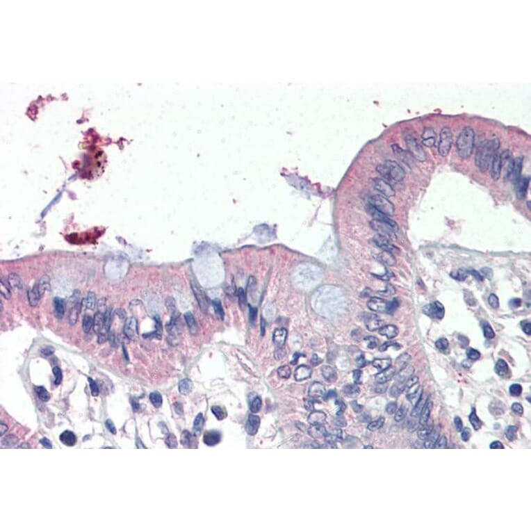 Immunohistochemistry - Anti-SCNN1G Antibody (A286000) - Antibodies.com