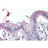 Immunohistochemistry - Anti-SCNN1G Antibody (A286000) - Antibodies.com