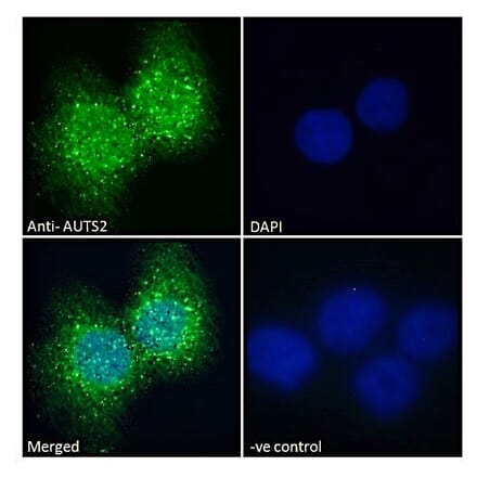 Immunofluorescence - Anti-AUTS2 Antibody (A286001) - Antibodies.com