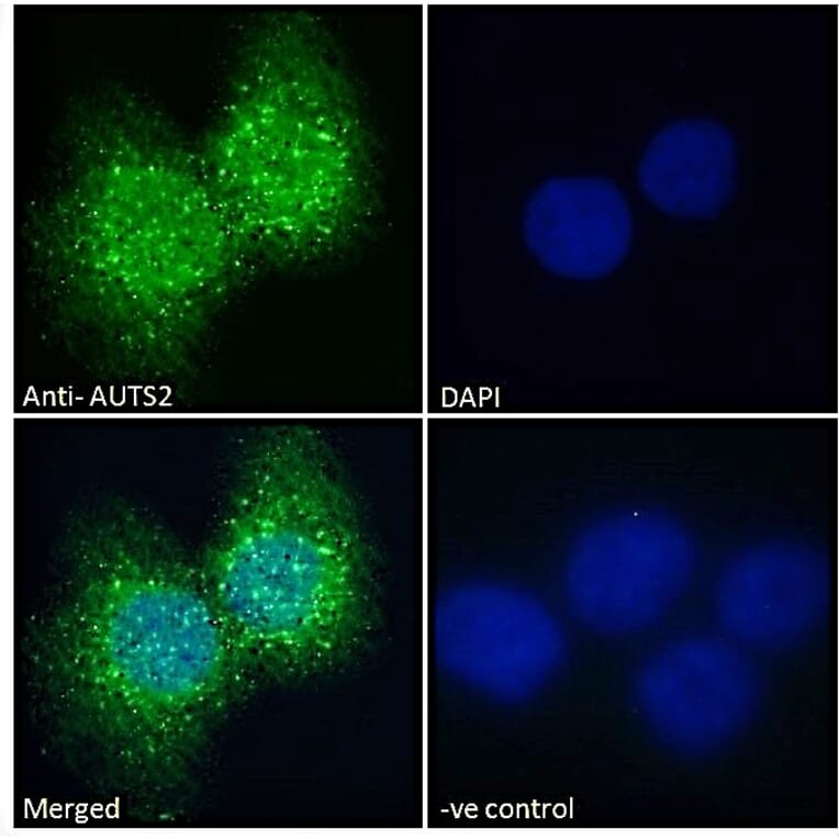 Immunofluorescence - Anti-AUTS2 Antibody (A286001) - Antibodies.com