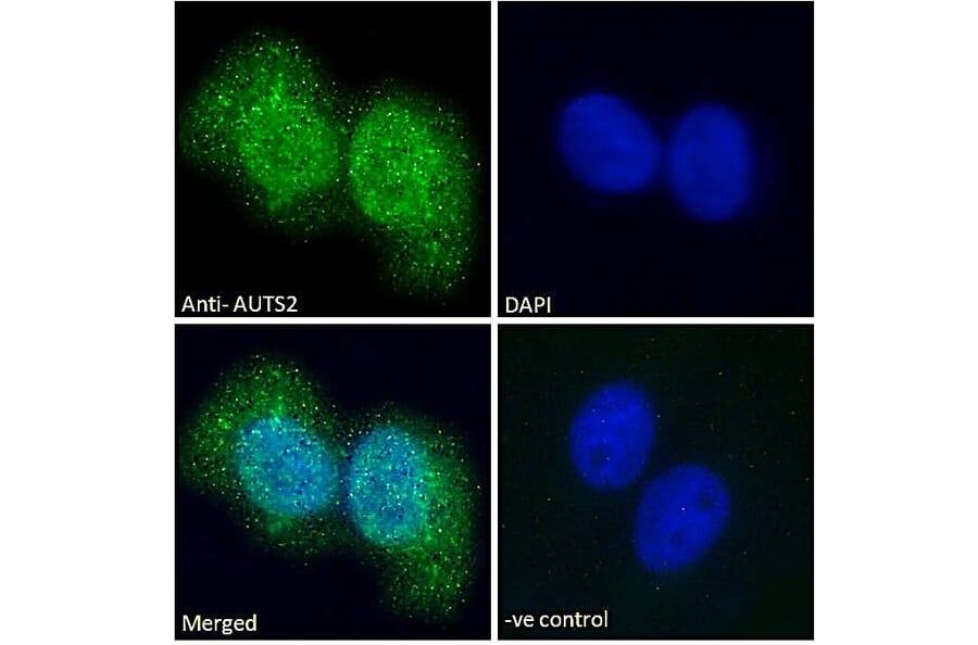 Immunofluorescence - Anti-AUTS2 Antibody (A286001) - Antibodies.com