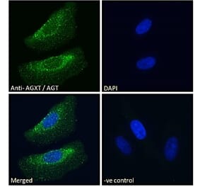 Immunofluorescence - Anti-AGXT Antibody (A286004) - Antibodies.com