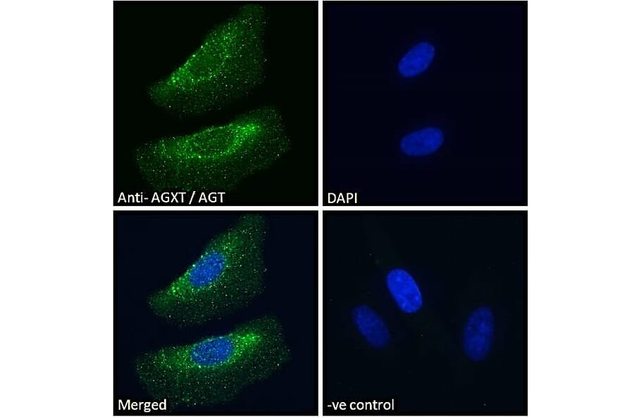 Immunofluorescence - Anti-AGXT Antibody (A286004) - Antibodies.com