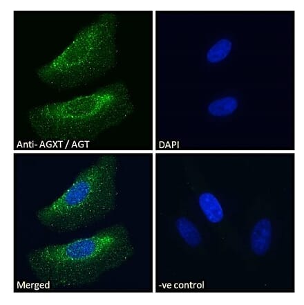Immunofluorescence - Anti-AGXT Antibody (A286004) - Antibodies.com