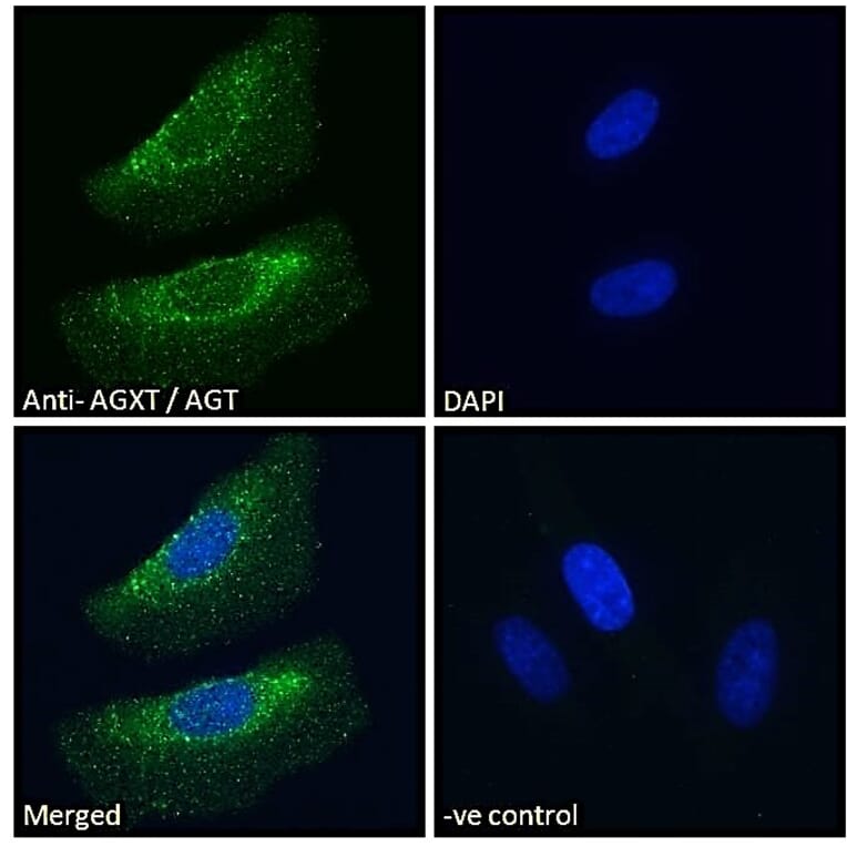 Immunofluorescence - Anti-AGXT Antibody (A286004) - Antibodies.com