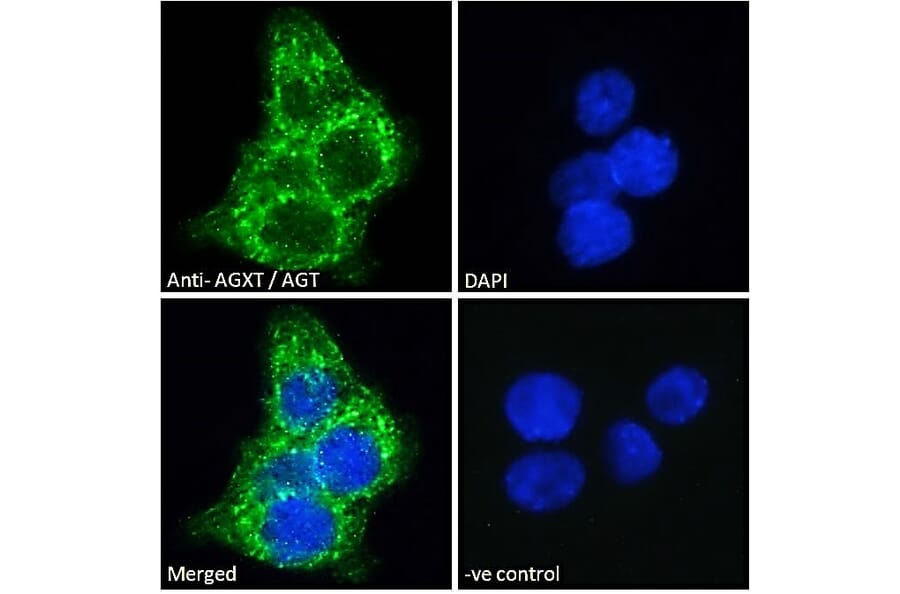 Immunofluorescence - Anti-AGXT Antibody (A286004) - Antibodies.com