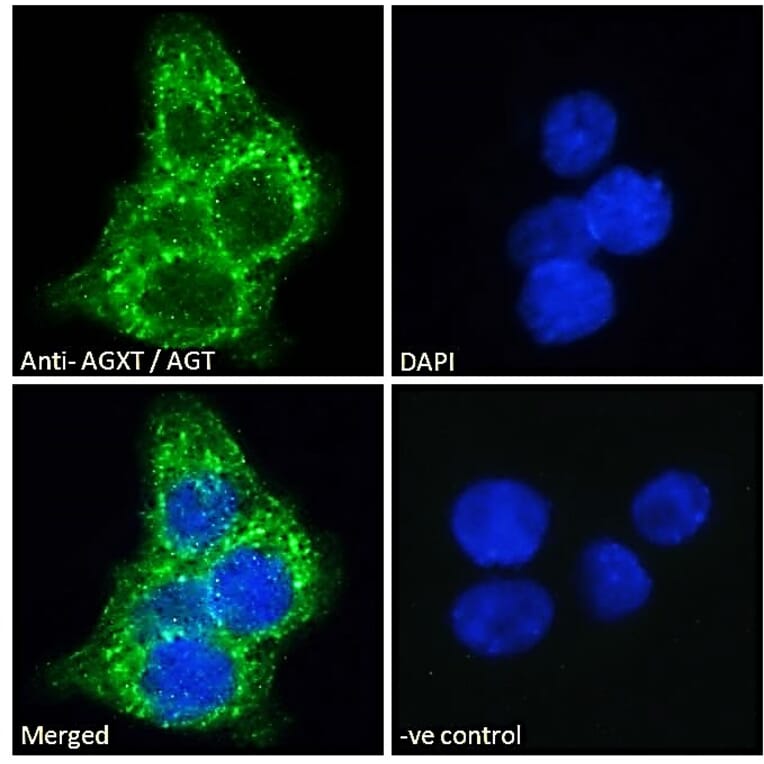 Immunofluorescence - Anti-AGXT Antibody (A286004) - Antibodies.com