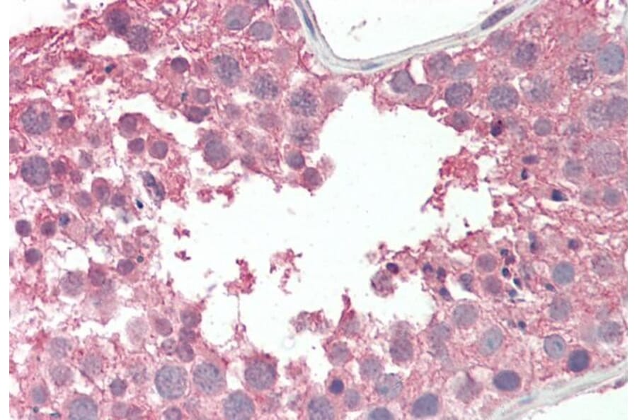 Immunohistochemistry - Anti-RCBTB2 Antibody (A286005) - Antibodies.com