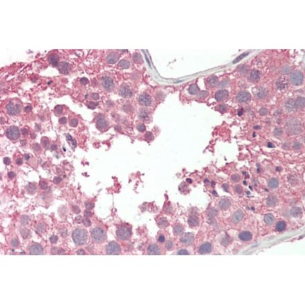 Immunohistochemistry - Anti-RCBTB2 Antibody (A286005) - Antibodies.com