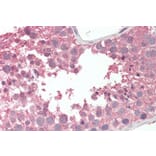 Immunohistochemistry - Anti-RCBTB2 Antibody (A286005) - Antibodies.com