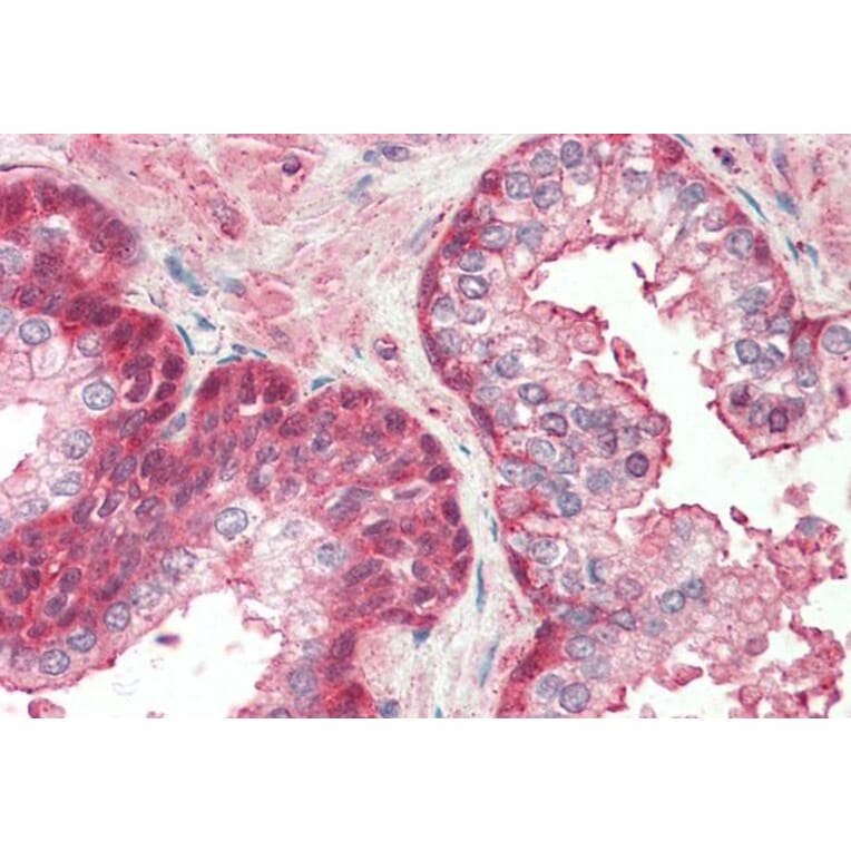 Immunohistochemistry - Anti-RCBTB2 Antibody (A286005) - Antibodies.com