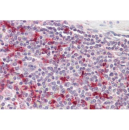 Immunohistochemistry - Anti-Thymosin alpha 1 Antibody (A286006) - Antibodies.com