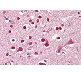 Immunohistochemistry - Anti-GluK5 Antibody (A286010) - Antibodies.com