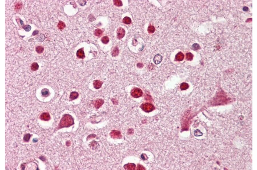 Immunohistochemistry - Anti-GluK5 Antibody (A286010) - Antibodies.com