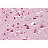 Immunohistochemistry - Anti-GluK5 Antibody (A286010) - Antibodies.com