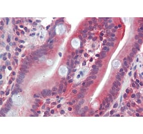 Immunohistochemistry - Anti-GLUT5 Antibody (A286017) - Antibodies.com