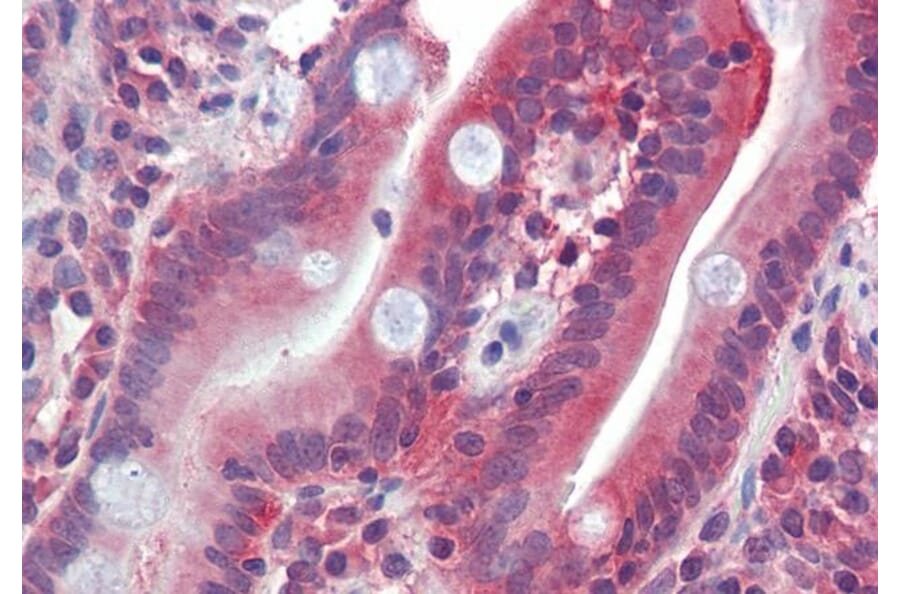 Immunohistochemistry - Anti-GLUT5 Antibody (A286017) - Antibodies.com