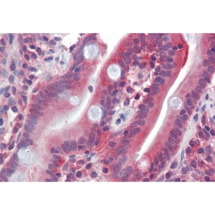 Immunohistochemistry - Anti-GLUT5 Antibody (A286017) - Antibodies.com