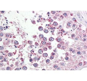 Immunohistochemistry - Anti-RAP80 Antibody (A286018) - Antibodies.com