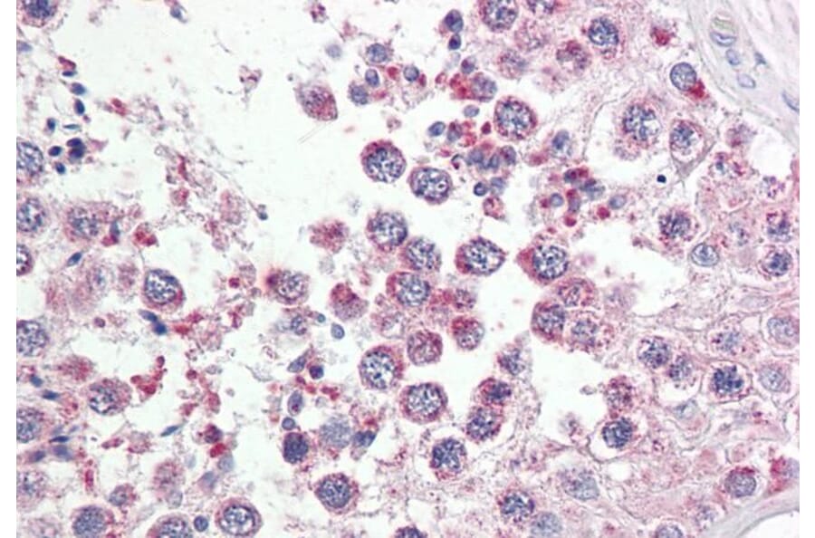 Immunohistochemistry - Anti-RAP80 Antibody (A286018) - Antibodies.com