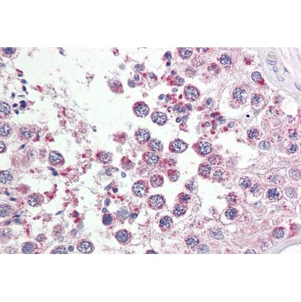 Immunohistochemistry - Anti-RAP80 Antibody (A286018) - Antibodies.com