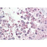 Immunohistochemistry - Anti-RAP80 Antibody (A286018) - Antibodies.com