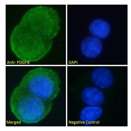 Immunofluorescence - Anti-PDGF B Antibody (A286019) - Antibodies.com