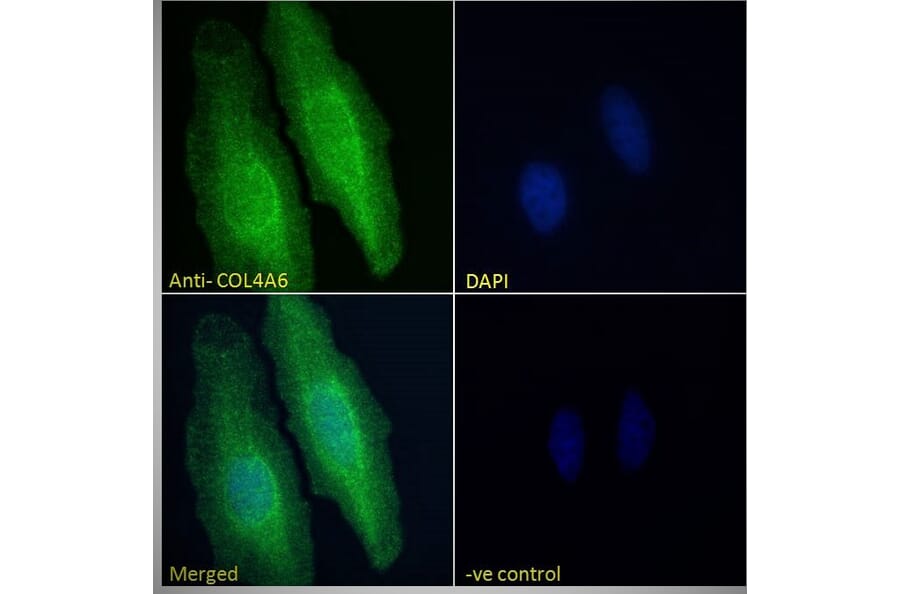 Immunofluorescence - Anti-Collagen IV alpha 6 Antibody (A286021) - Antibodies.com