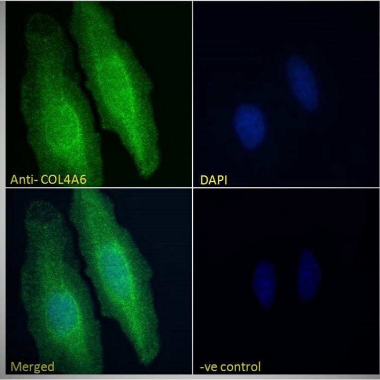 Immunofluorescence - Anti-Collagen IV alpha 6 Antibody (A286021) - Antibodies.com