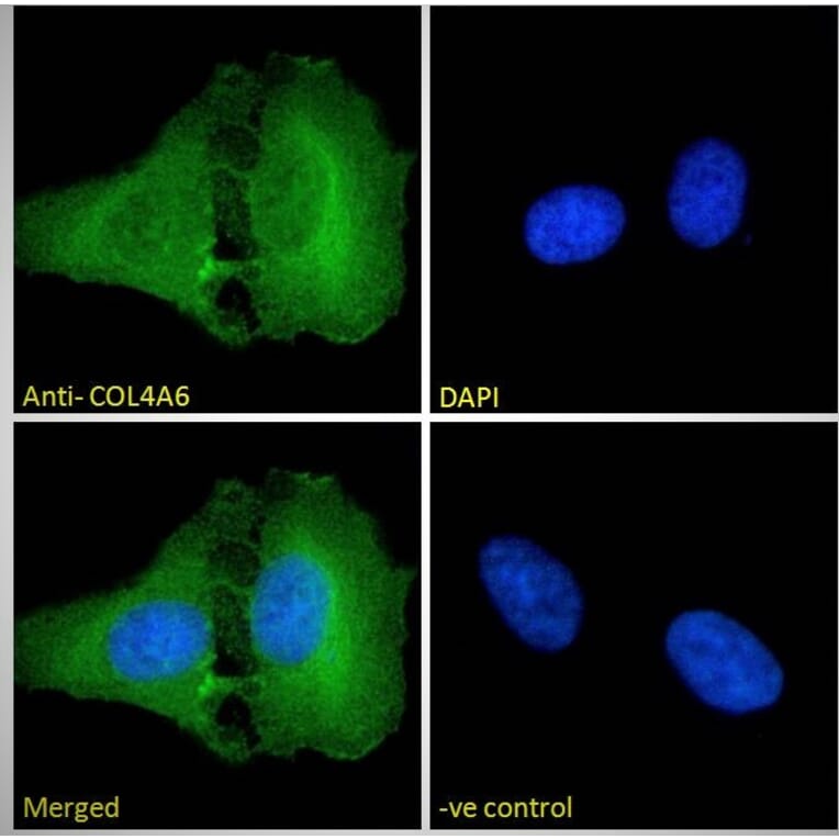 Immunofluorescence - Anti-Collagen IV alpha 6 Antibody (A286021) - Antibodies.com