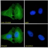 Immunofluorescence - Anti-Collagen IV alpha 6 Antibody (A286021) - Antibodies.com