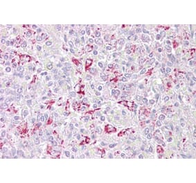 Immunohistochemistry - Anti-PFKFB2 Antibody (A286024) - Antibodies.com