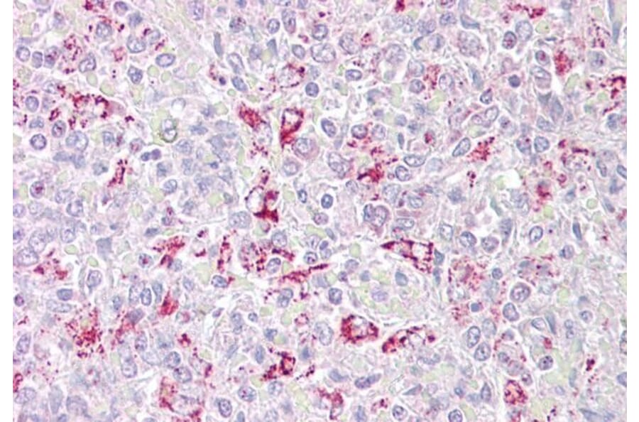 Immunohistochemistry - Anti-PFKFB2 Antibody (A286024) - Antibodies.com
