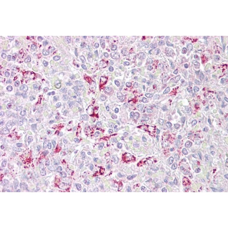 Immunohistochemistry - Anti-PFKFB2 Antibody (A286024) - Antibodies.com