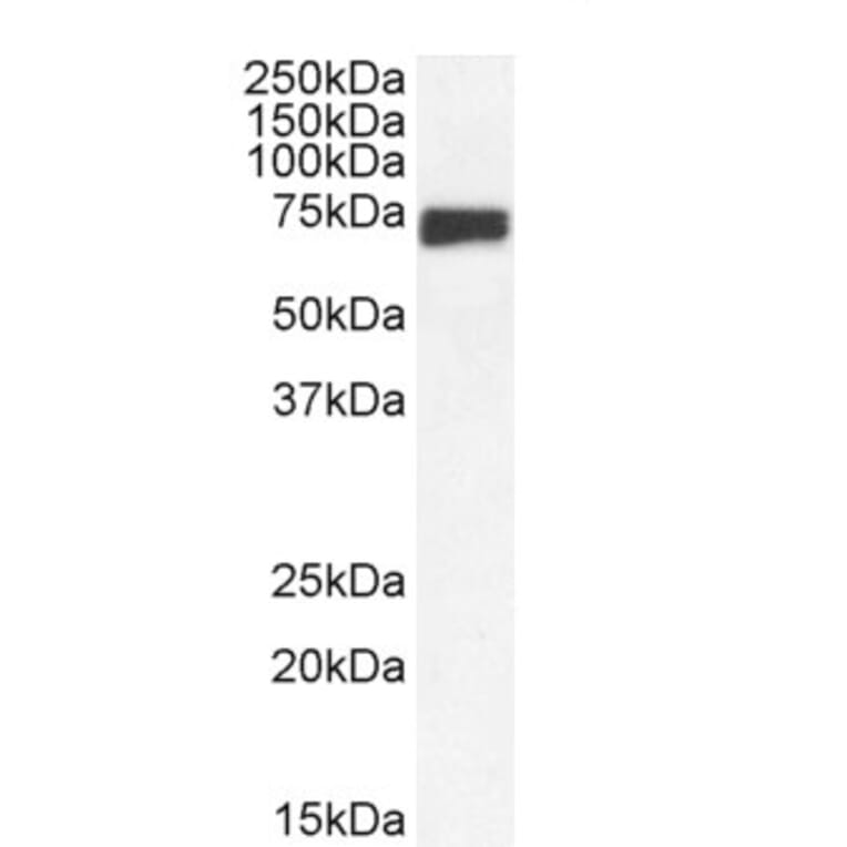 Western Blot - Anti-mnt Antibody (A286025) - Antibodies.com