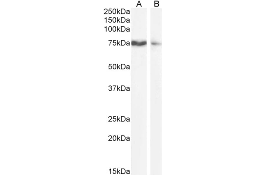 Western Blot - Anti-SLCO1B3/OATP1B3 Antibody (A286028) - Antibodies.com