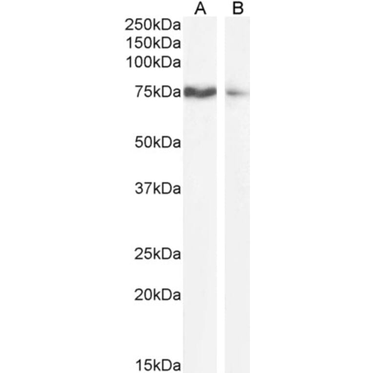 Western Blot - Anti-SLCO1B3/OATP1B3 Antibody (A286028) - Antibodies.com