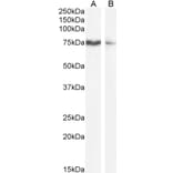 Western Blot - Anti-SLCO1B3/OATP1B3 Antibody (A286028) - Antibodies.com
