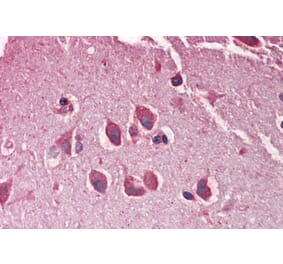 Immunohistochemistry - Anti-MXRA5 Antibody (A286029) - Antibodies.com