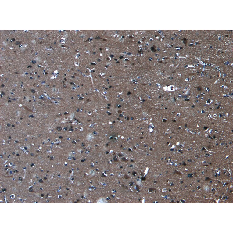 Immunohistochemistry - Anti-PCDH11Y/PCDH11X Antibody (A286031) - Antibodies.com