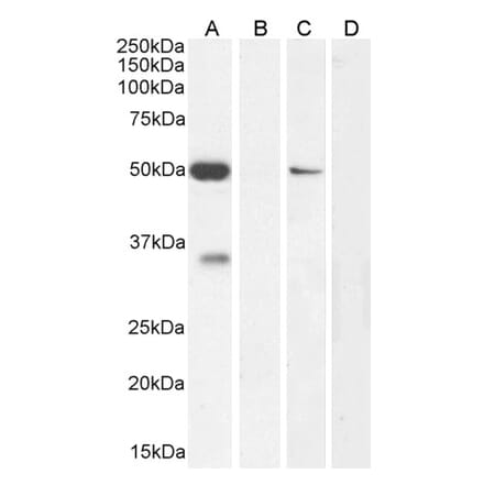 Western Blot - Anti-KCNN4 Antibody (A286034) - Antibodies.com