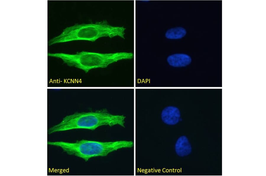 Immunofluorescence - Anti-KCNN4 Antibody (A286034) - Antibodies.com