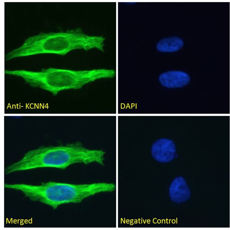 Immunofluorescence - Anti-KCNN4 Antibody (A286034) - Antibodies.com