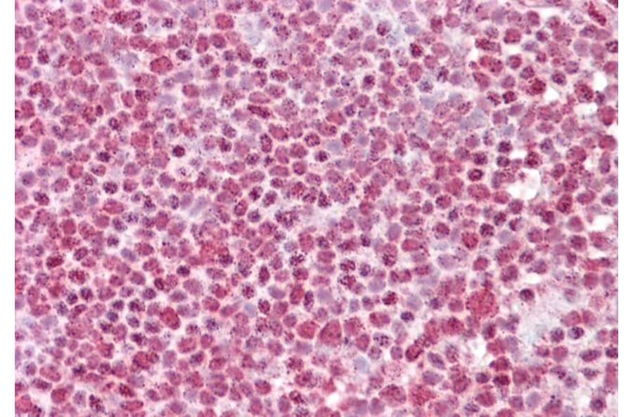 Immunohistochemistry - Anti-FBXO4/FBX4 Antibody (A286037) - Antibodies.com